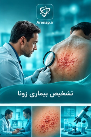 تشخیص بیماری-ارناپ