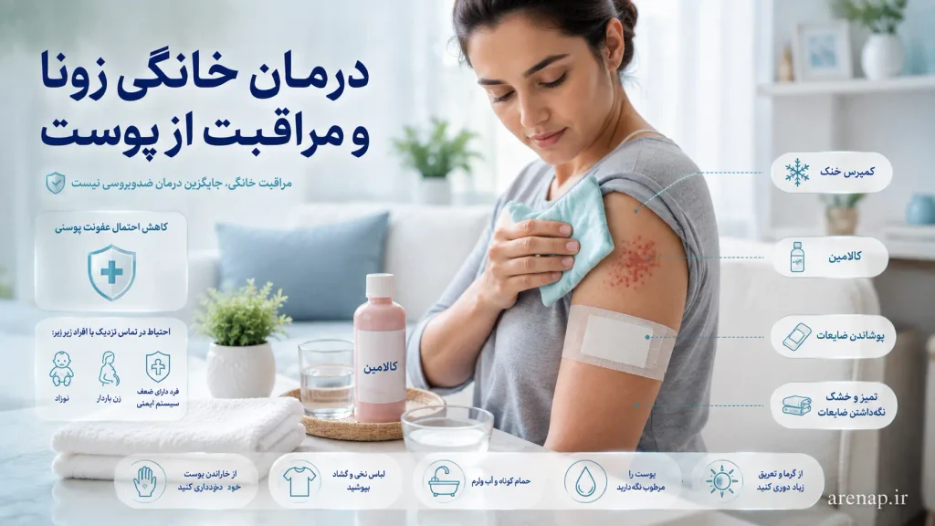 تصویر مراقبت خانگی از پوست زونا با کمپرس خنک، کالامین و پوشاندن ضایعات در کنار درمان بیماری زونا