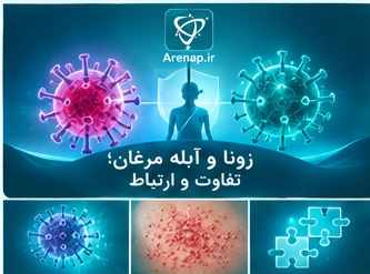 تفاوت زونا و آبله مرغان-ارناپ