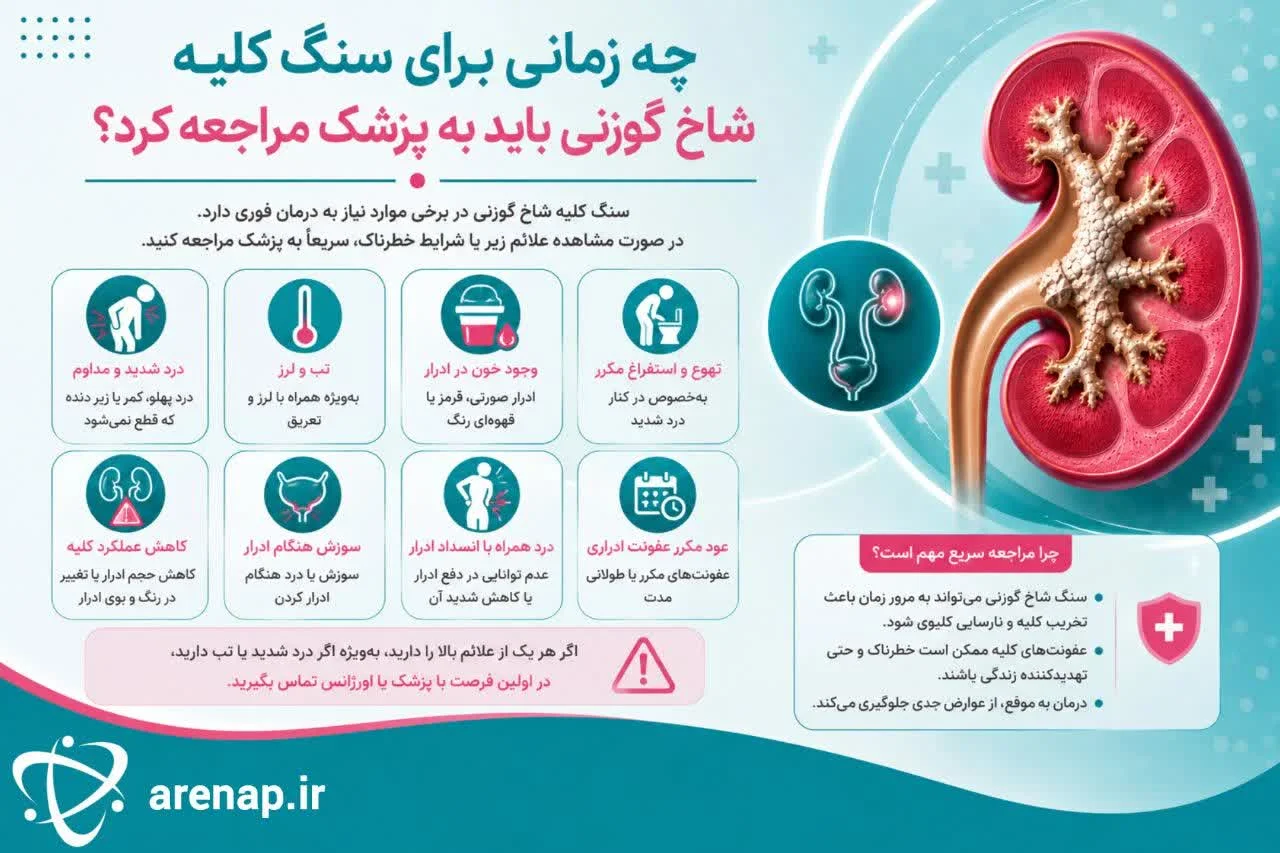 چه زمانی برای سنگ کلیه شاخ گوزنی باید به پزشک مراجعه کرد؟-ارناپ