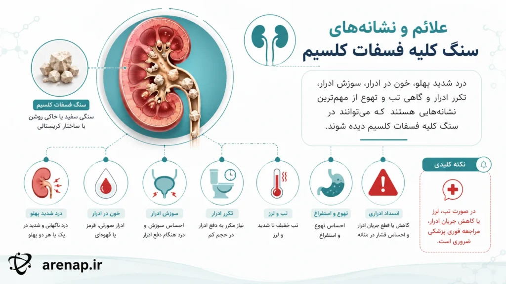 علائم و نشانه‌های سنگ کلیه فسفات کلسیم - arenap