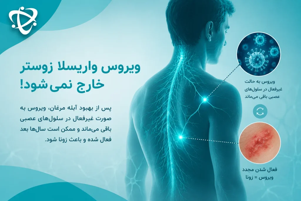 ماندگاری ویروس آبله مرغان؛ باقی ماندن واریسلا زوستر در سلول‌های عصبی و احتمال بروز زونا