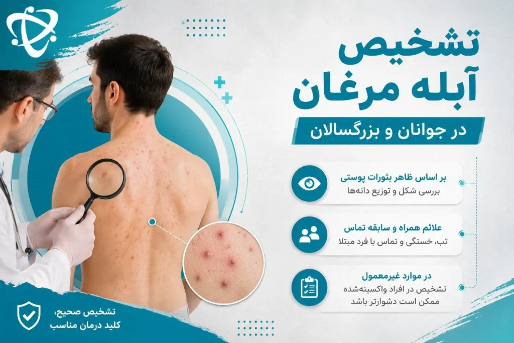 تشخیص آبله مرغان؛ بررسی بثورات پوستی، علائم بیماری و سابقه تماس با فرد مبتلا