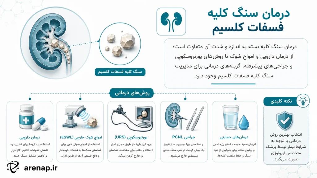 درمان سنگ کلیه فسفات کلسیم - arenap
