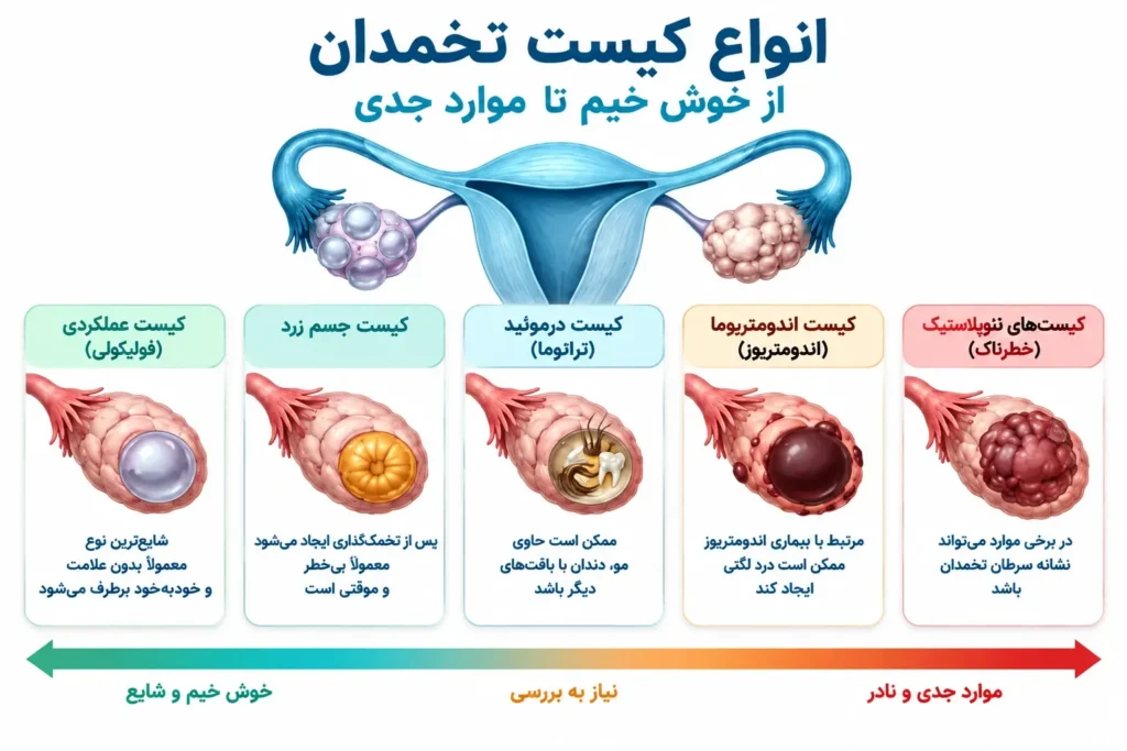 انواع کیست تخمدان - آرناپ