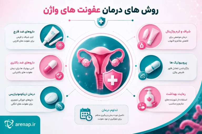 روش درمان عفونت واژن - آرناپ