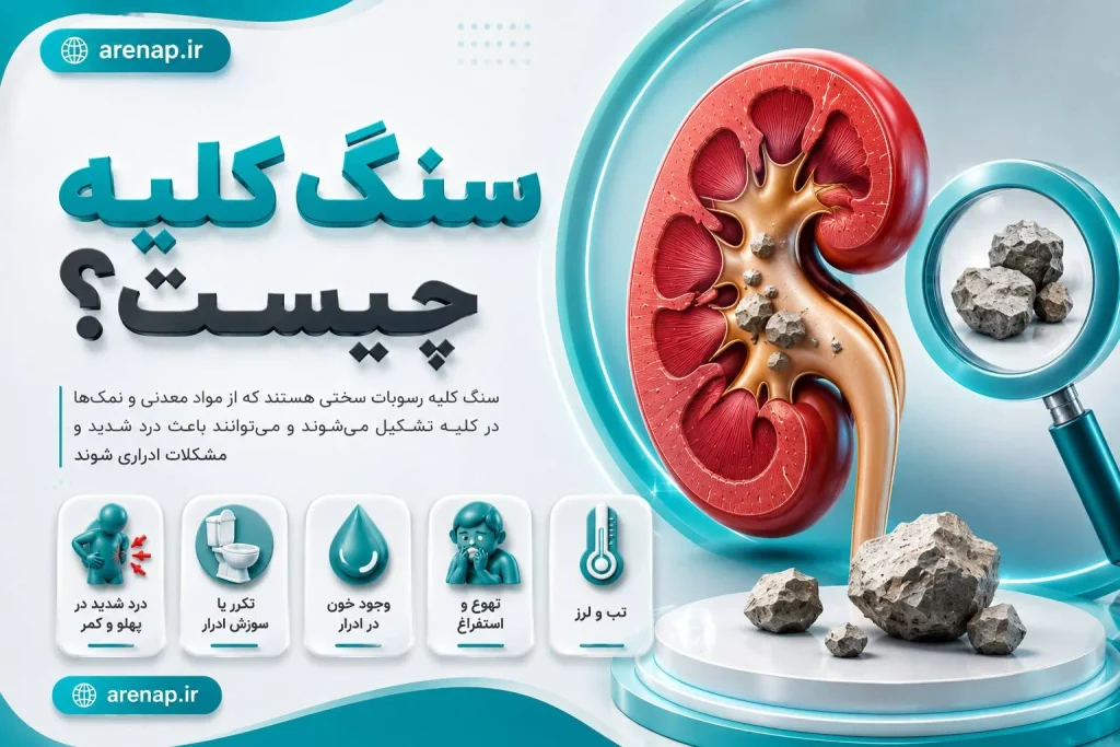 سنگ کلیه چیست و چگونه باعث درد می‌شود؟-آرناپ