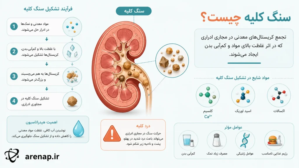 ماهیت و نحوه تشکیل سنگ کلیه
