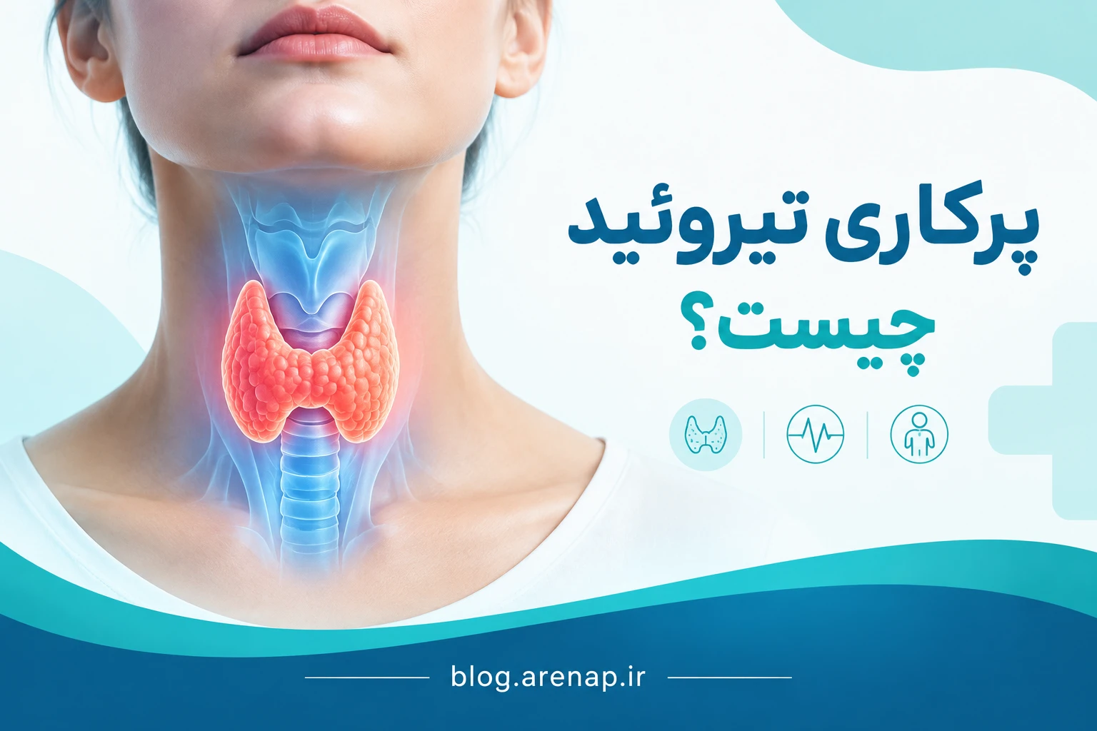 پرکاری تیروئید چیست؟ علائم، علت، عوارض و روش‌های درمان - مجله سلامت آرناپ