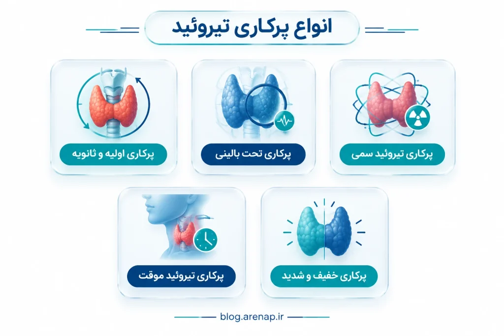 اینفوگرافیک دستهبندی انواع پرکاری تیروئید شامل اولیه و ثانویه، تحت بالینی، سمی، موقت و خفیف تا شدید - آرناپ